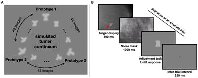 Idiosyncratic biases in the perception of medical images